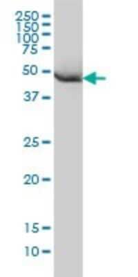 Western Blot: HARS Antibody (1C8) [H00003035-M01]