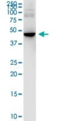 Western Blot: HARS Antibody (4D4) [H00003035-M03]