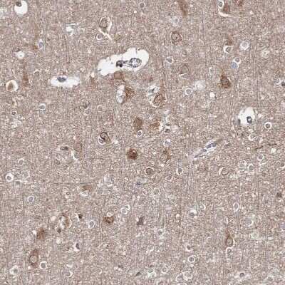 Immunohistochemistry-Paraffin: HARS Antibody [NBP1-89490]