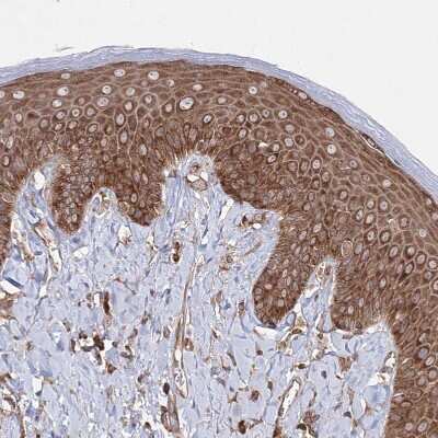 Immunohistochemistry-Paraffin: HARS Antibody [NBP1-89490]