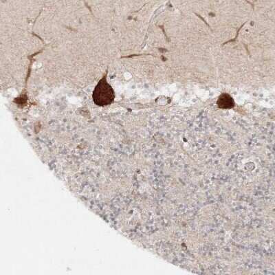 Immunohistochemistry-Paraffin: HARS Antibody [NBP1-89490]