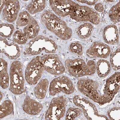 Immunohistochemistry-Paraffin: HARS Antibody [NBP1-89490]