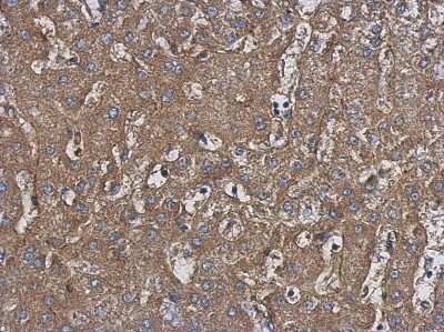 Immunohistochemistry-Paraffin: HARS Antibody [NBP2-16781]