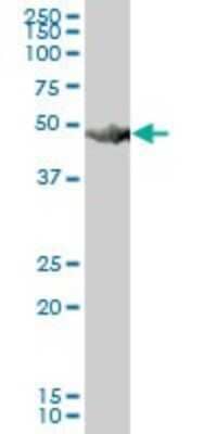 Western Blot: HARS Antibody [H00003035-B01P]