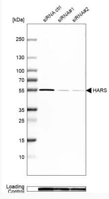 Western Blot: HARS Antibody [NBP1-89490]