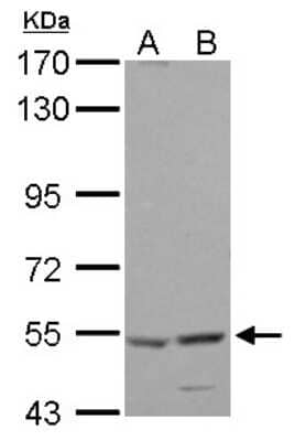 Western Blot: HARS Antibody [NBP2-16781]