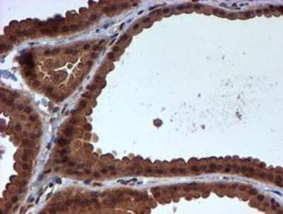 Immunohistochemistry-Paraffin: HARS2 Antibody (OTI5H2) [NBP2-01425]