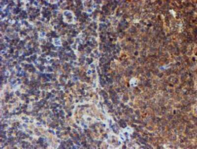 Immunohistochemistry-Paraffin: HARS2 Antibody (OTI5H2) [NBP2-01425]