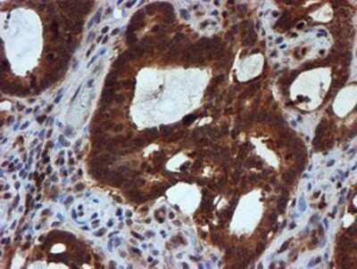 Immunohistochemistry: HARS2 Antibody (OTI5H2) - Azide and BSA Free [NBP2-71739]