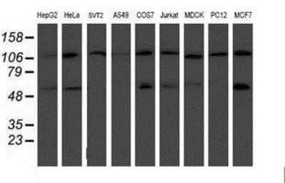 Western Blot: HARS2 Antibody (OTI5H2)Azide and BSA Free [NBP2-71739]