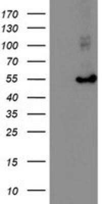 Western Blot: HARS2 Antibody (OTI5H2)Azide and BSA Free [NBP2-71739]