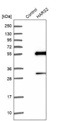 Western Blot: HARS2 Antibody [NBP1-81775]