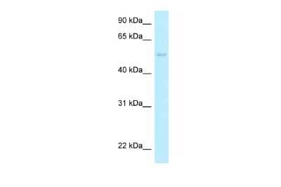 Western Blot: HARS2 Antibody [NBP2-85025]