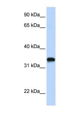 Western Blot: Hyaluronan Synthase 3/HAS3 Antibody [NBP1-62552]