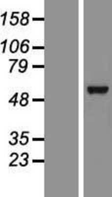 Western Blot: Hyaluronan Synthase 3/HAS3 Overexpression Lysate [NBP2-07763]