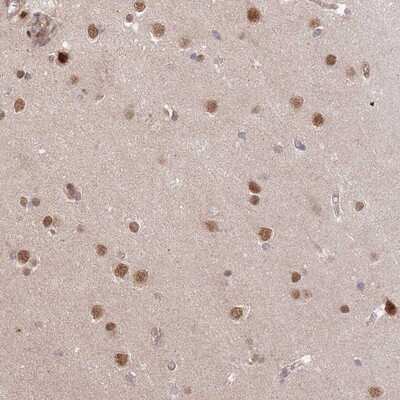 Immunohistochemistry-Paraffin: HAUS3 Antibody [NBP2-14630]