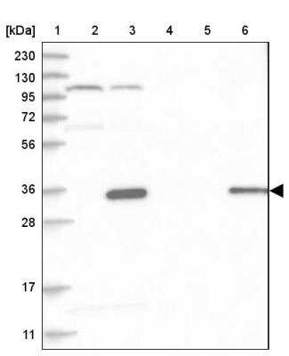 Western Blot: HAUS4 Antibody [NBP1-90722]