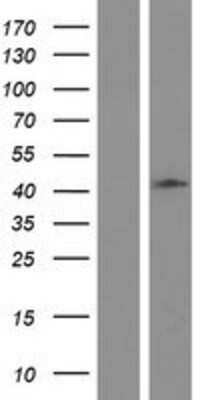 Western Blot: HAUS4 Overexpression Lysate [NBP2-06913]