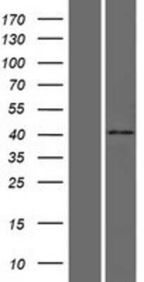 Western Blot: HAUS4 Overexpression Lysate [NBP2-10247]