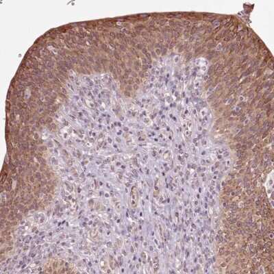 Immunohistochemistry-Paraffin: HAUS5 Antibody [NBP2-38104]