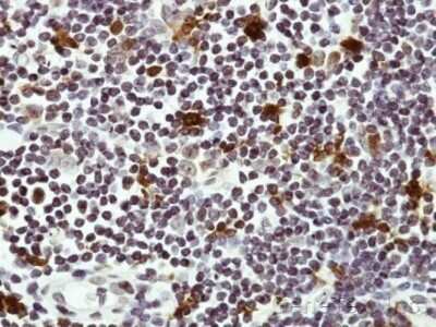 Immunohistochemistry-Paraffin: HAUS8 Antibody [NBP2-42849]