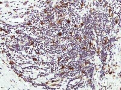 Immunohistochemistry-Paraffin: HAUS8 Antibody [NBP2-42849]