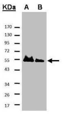Western Blot: HAUS8 Antibody [NBP2-42849]