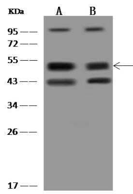 Western Blot: HAUS8 Antibody [NBP3-12653]