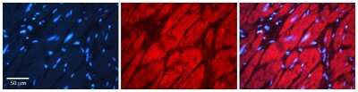 Immunohistochemistry: HAX-1 Antibody [NBP1-54800]