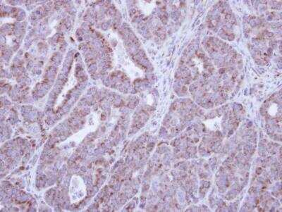 Immunohistochemistry-Paraffin: HAX-1 Antibody [NBP1-31647]