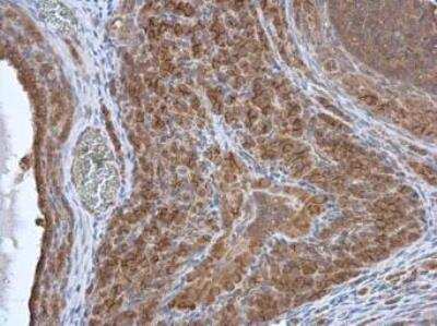 Immunohistochemistry-Paraffin: HAX-1 Antibody [NBP1-31647]