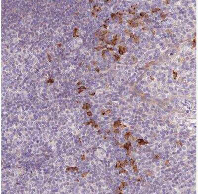 Immunohistochemistry-Paraffin: HAX-1 Antibody [NBP2-49169]