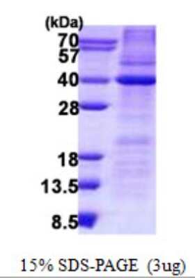 SDS-PAGE: Recombinant Human HAX-1 His Protein [NBP2-23101]