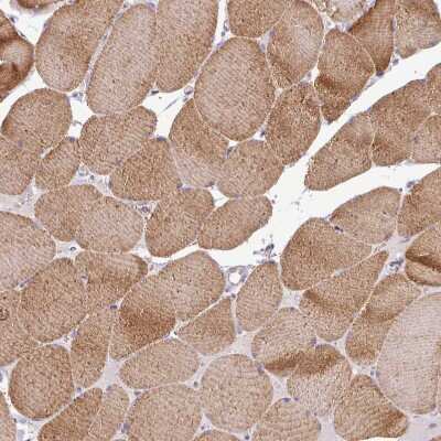 Immunohistochemistry-Paraffin: HB-EGF Antibody [NBP2-14082]