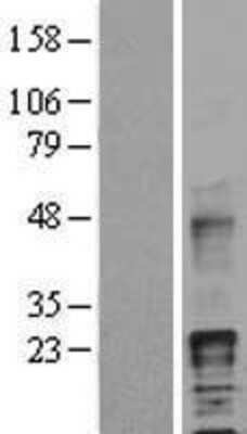 Western Blot: HB-EGF Overexpression Lysate [NBL1-11459]