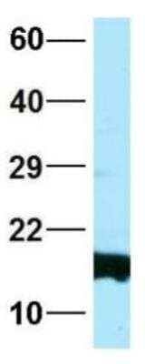 Western Blot: HBG1/2 Antibody [NBP1-98291]