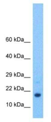 Western Blot: HBG1/2 Antibody [NBP2-86665]