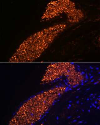 Immunohistochemistry: HBG1 Antibody (1R9T7) [NBP3-15298]