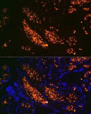 Immunohistochemistry: HBG1 Antibody (6F1A8) [NBP3-15299]