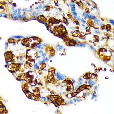 Immunohistochemistry-Paraffin: HBG1 Antibody (6F1A8) [NBP3-15299]