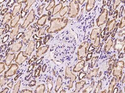 Immunohistochemistry-Paraffin: HBLD1 Antibody [NBP2-97947]