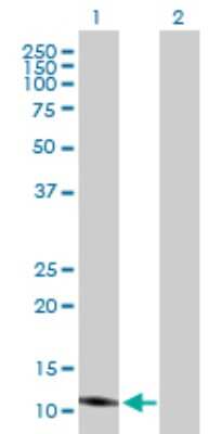 Western Blot: HBLD1 Antibody [H00122961-B01P]