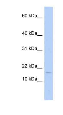 Western Blot: HBLD1 Antibody [NBP1-54718]