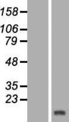 Western Blot: HBLD1 Overexpression Lysate [NBL1-12044]