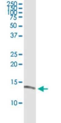 Western Blot: HBLD2 Antibody (1A11) [H00081689-M02]