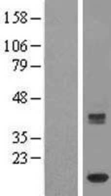 Western Blot: HBLD2 Overexpression Lysate [NBL1-12043]