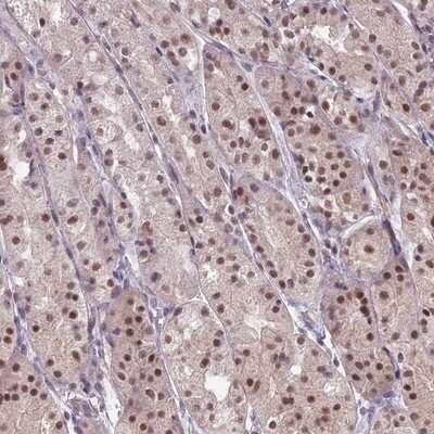 Immunohistochemistry-Paraffin: HBO1 Antibody [NBP1-92161]