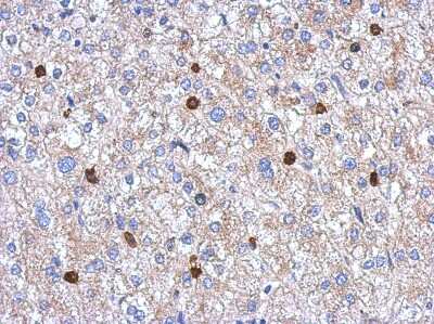 Immunohistochemistry-Paraffin: HBO1 Antibody [NBP2-16784]