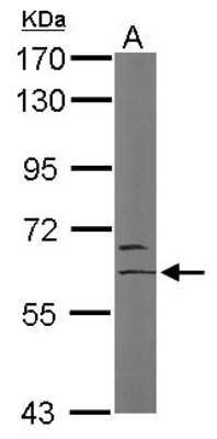 Western Blot: HBO1 Antibody [NBP2-16784]