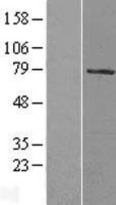 Western Blot: HBO1 Overexpression Lysate [NBL1-13448]